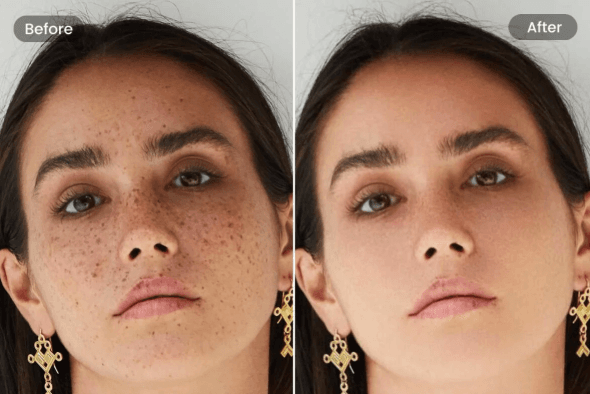 Flawless Skin in Seconds – Free AI Acne & Blemish Remover