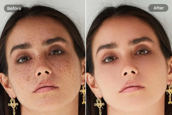 Remove Marks on Face AI